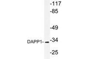 Western blot analysis of DAPP1 antibody in extracts from 293 cells.