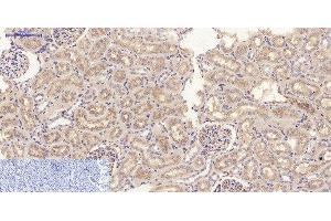 Immunohistochemistry of paraffin-embedded Rat kidney tissue using JAK2 Polyclonal Antibody at dilution of 1:200. (JAK2 antibody)
