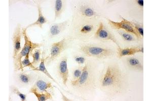 ICC testing of HeLa cells with HLA-C antibody. (HLA-C antibody)
