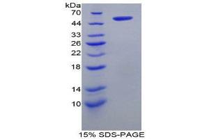 SDS-PAGE (SDS) image for Solute Carrier Family 27 (Fatty Acid Transporter), Member 5 (SLC27A5) (AA 488-690) protein (His tag,GST tag) (ABIN2122822) (SLC27A5 Protein (AA 488-690) (His tag,GST tag))