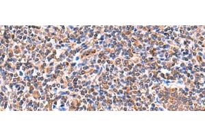 Immunohistochemistry of paraffin-embedded Human tonsil tissue using ISM1 Polyclonal Antibody at dilution of 1:60(x200)