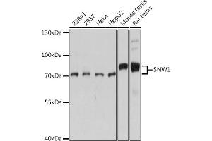 Western blot analysis of extracts of various cell lines, using SNW1 antibody (ABIN7270386) at 1:1000 dilution. (SNW1 antibody  (AA 300-536))