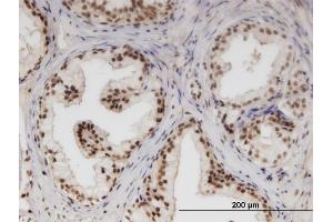 Immunoperoxidase of monoclonal antibody to NUPL1 on formalin-fixed paraffin-embedded human prostate. (NUPL1 antibody  (AA 323-422))