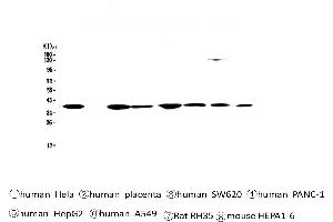 Western blot analysis of SMN1/2 using anti-SMN1/2 antibody . (SMN1 / SMN2 (AA 22-52), (N-Term) antibody)