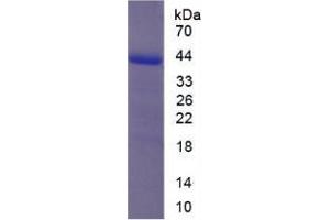 Image no. 1 for Inhibin, alpha (INHA) (AA 217-329) protein (His tag,GST tag) (ABIN6239902)