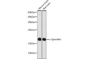 Western blot analysis of extracts of various cell lines, using α-Synuclein antibody (ABIN7270695) at 1:1000 dilution. (SNCA antibody  (AA 59-140))