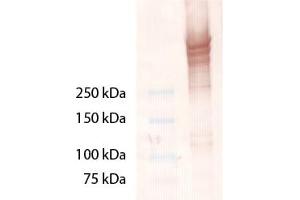 Western Blot analysis of Laminin 5. (Laminin 5 antibody)