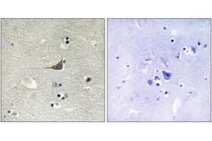 Immunohistochemistry analysis of paraffin-embedded human brain tissue, using GPR180 Antibody. (GPR180 antibody  (AA 241-290))