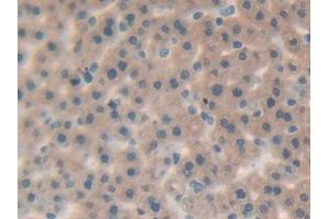 DAB staining on IHC-P; Samples: Rat Liver Tissue (IL-25 antibody  (AA 33-169))