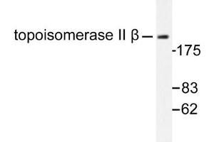 Image no. 1 for anti-Topoisomerase (DNA) II beta 180kDa (TOP2B) antibody (ABIN271965) (TOP2B antibody)