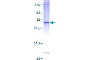 DIRAS3 Protein (AA 1-229) (GST tag)