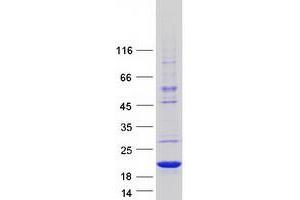 Validation with Western Blot (WHAMMP3 Protein (Myc-DYKDDDDK Tag))