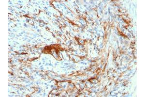 Formalin-fixed, paraffin-embedded human Small Intestine stained with Rabbit Recombinant Monoclonal Antibody (ELN/3131R) to Elastin.