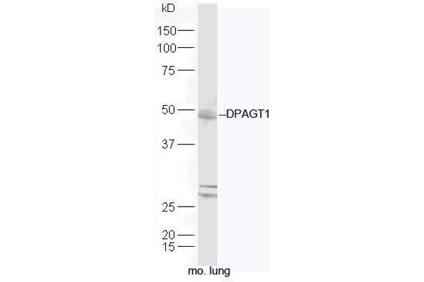 DPAGT1 antibody  (AA 301-408)