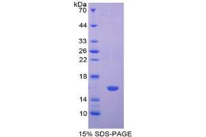 SDS-PAGE (SDS) image for Lectin, Galactoside-Binding, Soluble, 2 (LGALS2) (AA 1-130) protein (His tag) (ABIN2124909)