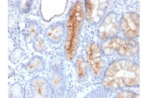 Immunohistochemistry (IHC) image for anti-Mucin 4, Cell Surface Associated (MUC4) (AA 1730-1864) antibody (ABIN6940125)