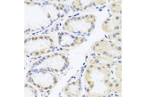 Immunohistochemistry of paraffin-embedded human stomach using RUNX1 antibody (ABIN6291786) at dilution of 1:100 (40x lens). (RUNX1 antibody)