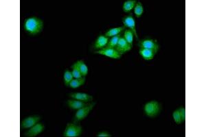 Immunofluorescence staining of HepG2 cells with ABIN7161257 at 1:166, counter-stained with DAPI. (NCDN antibody  (AA 403-516))