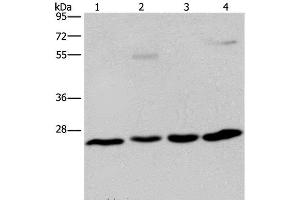 Western Blot analysis of A549 cell and Human hepatocellular carcinoma, Mouse liver tissue and HT-29 cell using ETHE1 Polyclonal Antibody at dilution of 1:400 (ETHE1 antibody)