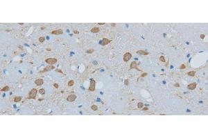 Immunohistochemistry of paraffin-embedded Mouse brain using TIMP4 Polyclonal Antibody at dilution of 1:50 (TIMP4 antibody)