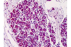 Anti-Poly ADP-Ribose antibody IHC of human breast. (Poly-ADP-Ribose antibody)
