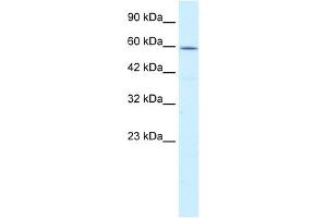 WB Suggested Anti-CCT4 Antibody Titration:  0. (CCT4 antibody  (C-Term))