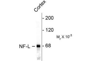 Image no. 1 for anti-Neurofilament, Light Polypeptide (NEFL) antibody (ABIN372673) (NEFL antibody)