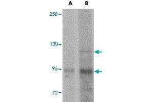 Western blot analysis of KDM3A in mouse liver tissue lysate with KDM3A polyclonal antibody  at (A) 1 and (B) 2 ug/mL . (KDM3A antibody  (N-Term))