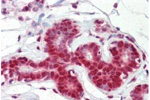 Human Breast (formalin-fixed, paraffin-embedded) stained with SNRPA antibody ABIN462227 followed by biotinylated goat anti-rabbit IgG secondary antibody ABIN481713, alkaline phosphatase-streptavidin and chromogen. (SNRPA1 antibody  (AA 191-240))