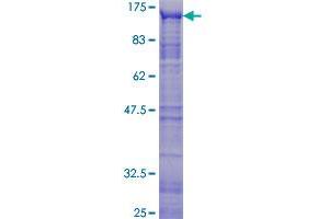 Image no. 1 for V-Myb Myeloblastosis Viral Oncogene Homolog (Avian)-Like 2 (MYBL2) (AA 1-700) protein (GST tag) (ABIN1311706) (MYBL2 Protein (AA 1-700) (GST tag))