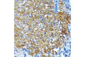 Immunohistochemistry of paraffin-embedded rat ovary using Leptin Receptor Rabbit mAb (ABIN7268210) at dilution of 1:100 (40x lens). (Leptin Receptor antibody)