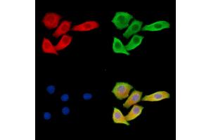 ABIN6263093 and ABIN6279535 staining Hela cells by IF/ICC.