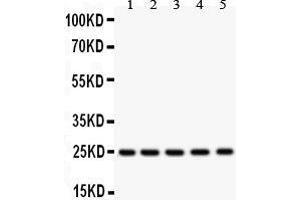 Anti-SOD2 Picoband antibody, Western blotting All lanes: Anti SOD2  at 0.