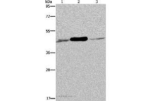 Western blot analysis of 293T and Jurkat cell, human fetal muscle tissue, using IDH2 Polyclonal Antibody at dilution of 1:600 (IDH2 antibody)