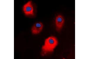 Immunofluorescent analysis of STEAP3 staining in HepG2 cells.