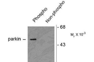 Image no. 1 for anti-Parkinson Protein 2, E3 Ubiquitin Protein Ligase (Parkin) (PARK2) (pSer378) antibody (ABIN372698) (Parkin antibody  (pSer378))