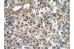 SQLE antibody was used for immunohistochemistry at a concentration of 4-8 ug/ml to stain Hepatocytes (arrows) in Human Liver. (SQLE antibody  (C-Term))