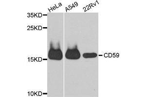 Western Blotting (WB) image for anti-CD59 (CD59) antibody (ABIN3022399)