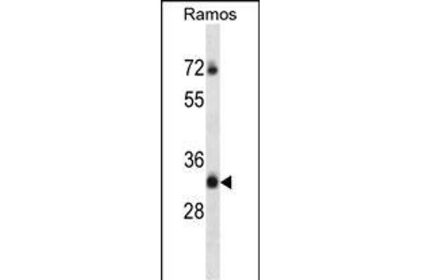 TMEM55B Antikörper  (C-Term)