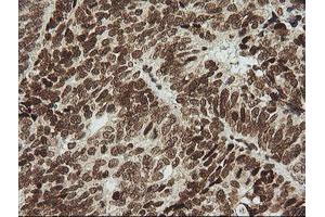 Image no. 1 for anti-Zinc Finger and SCAN Domain Containing 18 (ZSCAN18) antibody (ABIN1501857) (ZSCAN18 antibody)