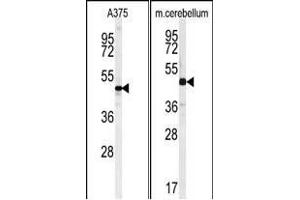 (LEFT)Western blot analysis of C10orf46 Antibody (C-term) (ABIN651189 and ABIN2840118) in  cell line lysates (35 μg/lane). (CACUL1 antibody  (C-Term))