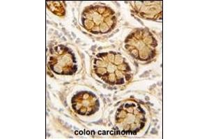 Immunohistochemistry (Paraffin-embedded Sections) (IHC (p)) image for anti-Platelet-Derived Growth Factor Receptor-Like (PDGFRL) (AA 328-357), (C-Term) antibody (ABIN392037)