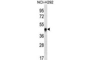 CALU Antibody (C-term) western blot analysis in NCI-H292 cell line lysates (35µg/lane).