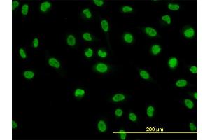 Immunofluorescence of monoclonal antibody to NFIC on HeLa cell. (NFIC antibody  (AA 314-423))