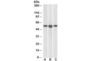Western blot testing of human breast [A], placenta [B] and spleen [C] lysates with ENT1 antibody at 1ug/ml. (SLC29A1 antibody)