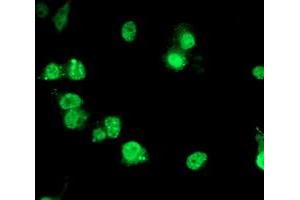 Anti-PDE4B mouse monoclonal antibody (ABIN2454961) immunofluorescent staining of COS7 cells transiently transfected by pCMV6-ENTRY PDE4B (RC211956). (PDE4B antibody)
