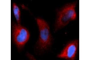 Immunofluorescence (IF) image for anti-Transforming Growth Factor, beta 1 (TGFB1) (AA 279-390) antibody (APC) (ABIN5566209) (TGFB1 antibody  (AA 279-390) (APC))