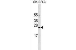 Western Blotting (WB) image for anti-Angiotensin II Receptor-Associated Protein (AGTRAP) antibody (ABIN3000225)