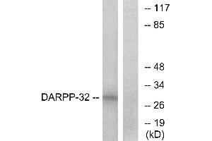 Western blot analysis of extracts from COS-7 cells, treated with forskolin (40nM, 30mins), using DARPP-32 (Ab-34) antibody. (DARPP32 antibody  (Thr34))