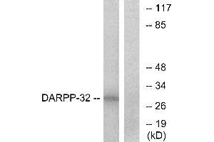 Western blot analysis of extracts from COS-7 cells, treated with forskolin (40nM, 30mins), using DARPP-32 (Ab-34) antibody.